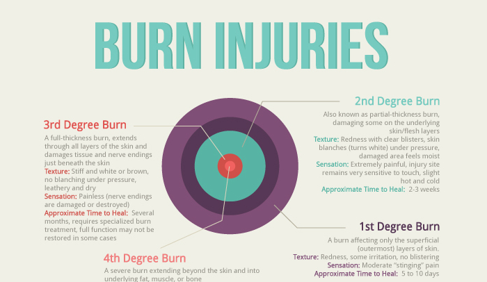 4th degree burn treatments