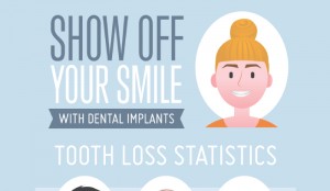 How do Dental Implants Work