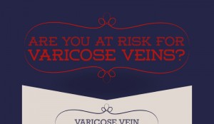 How to Prevent Varicose Veins on Legs