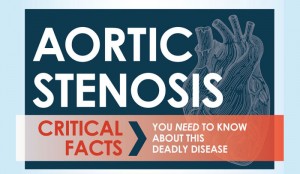 Aortic Valve Stenosis Causes, Symptoms and Treatments