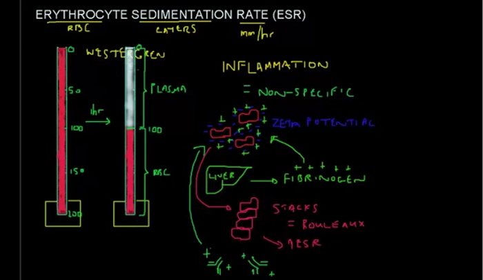 Erythrocyte Sedimentation Rate Esr