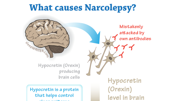 symptoms of narcolepsy type 1