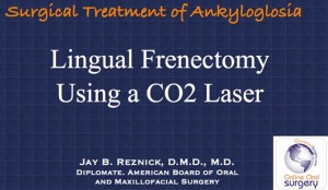 Lingual Frenectomy Recovery Time
