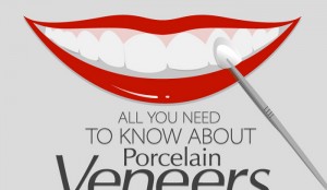 Porcelain Veneers Pros and Cons