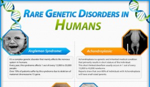 Famous People with Genetic Disorders