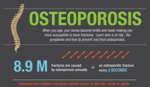 Famous People with Osteoporosis