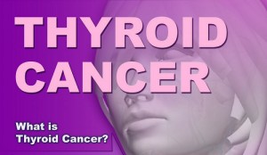 Famous People with Thyroid Cancer