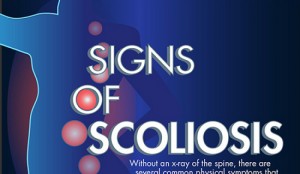 Levoscoliosis Symptoms