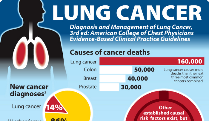 Famous People who Died from Lung Cancer - HRF