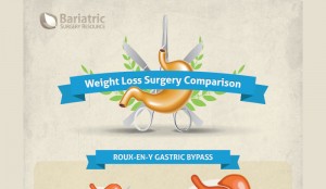 Pros and Cons of Lap Band Surgery