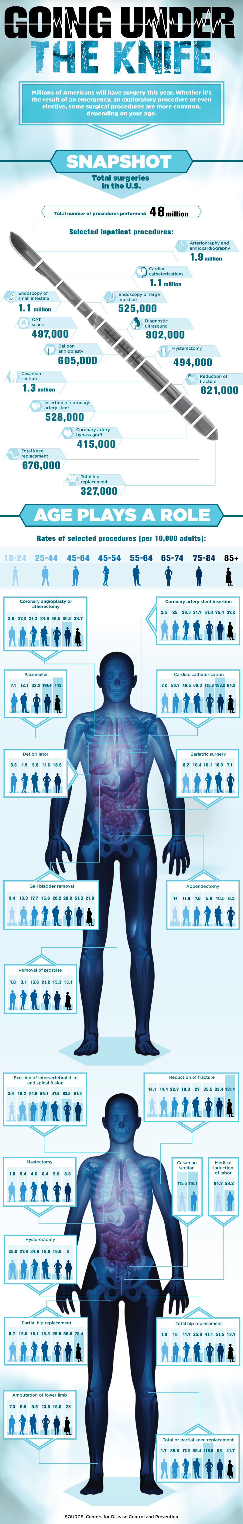 Surgery Statistics in the United States