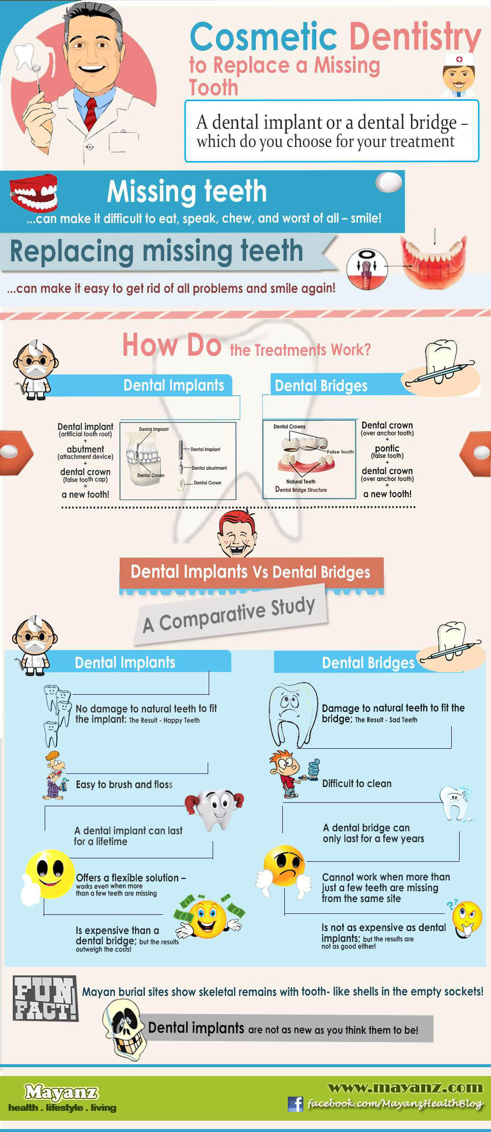 Dental Bridge Comparison