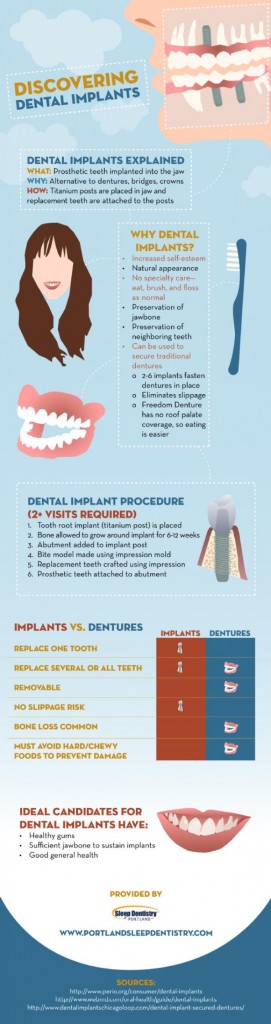 Dental Implants Pros and Cons - HRF