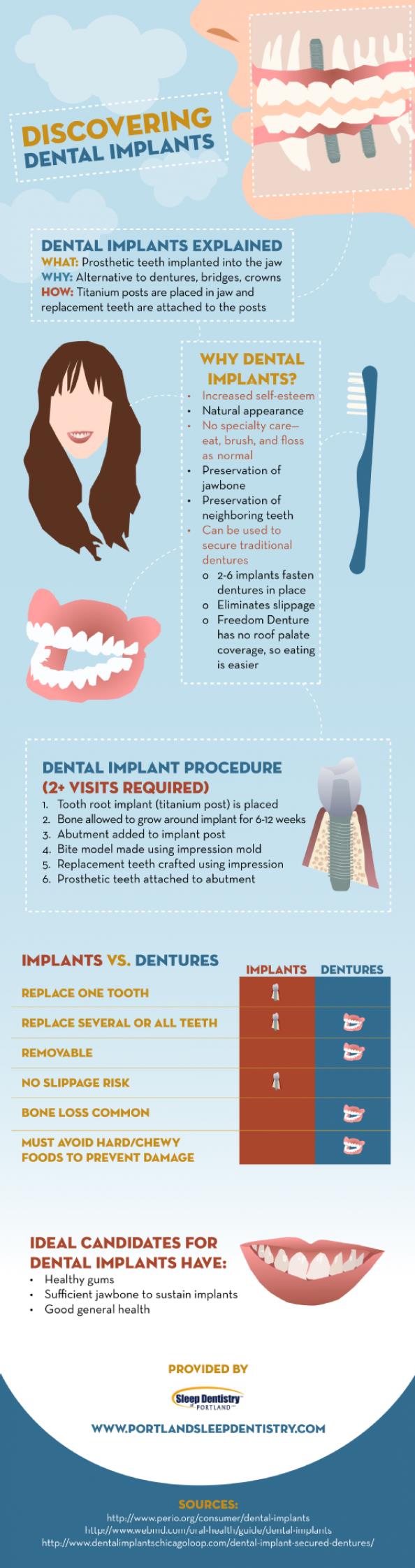 Dental Implant Facts