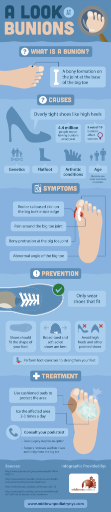 Guide to Bunions - HRF