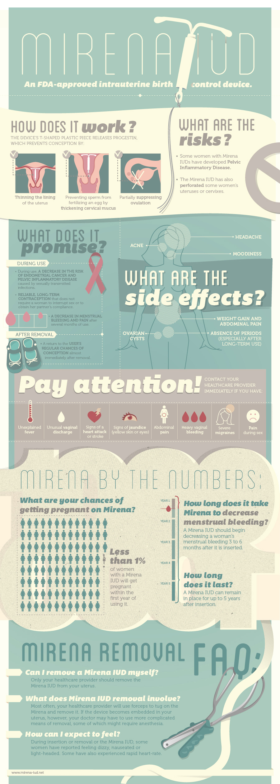 IUD Explained