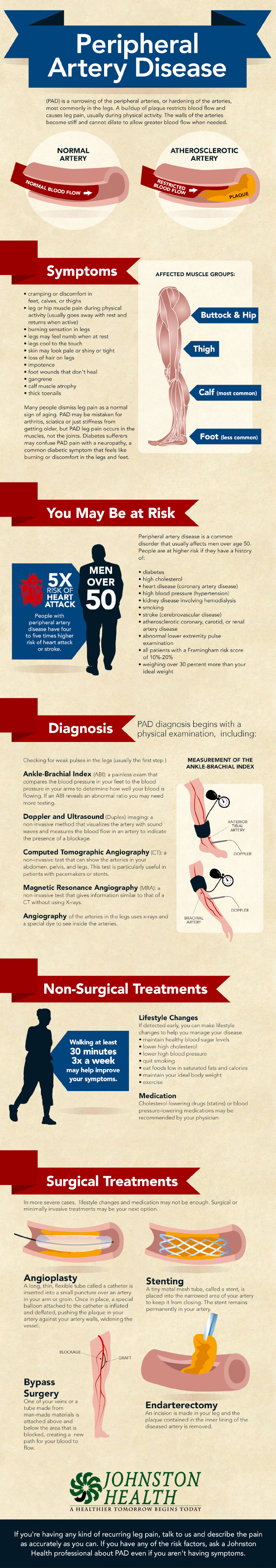 Peripheral Artery Disease