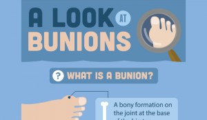 Pros and Cons of Bunion Surgery