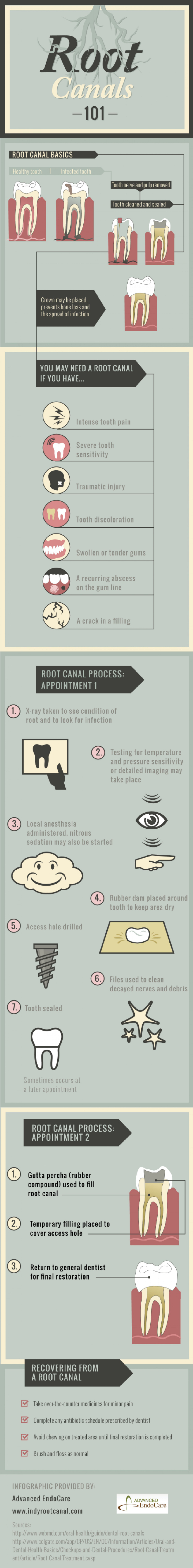 Root Canal Facts