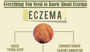 Dyshidrotic Eczema Home Remedies