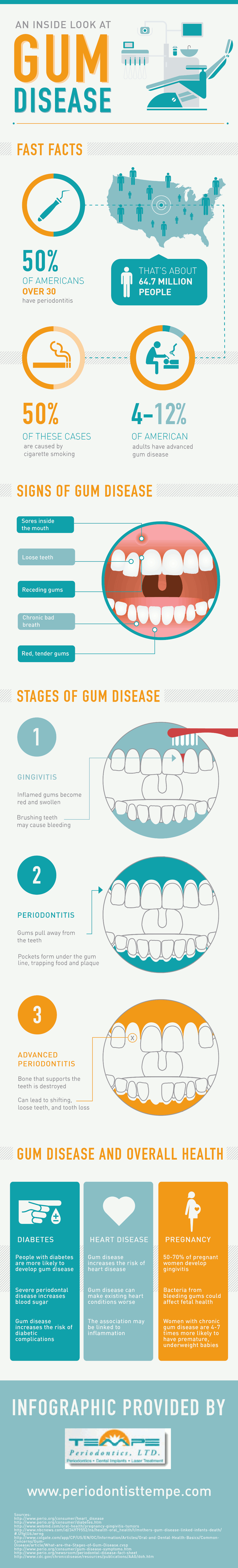 Gum Disease Facts and Statistics