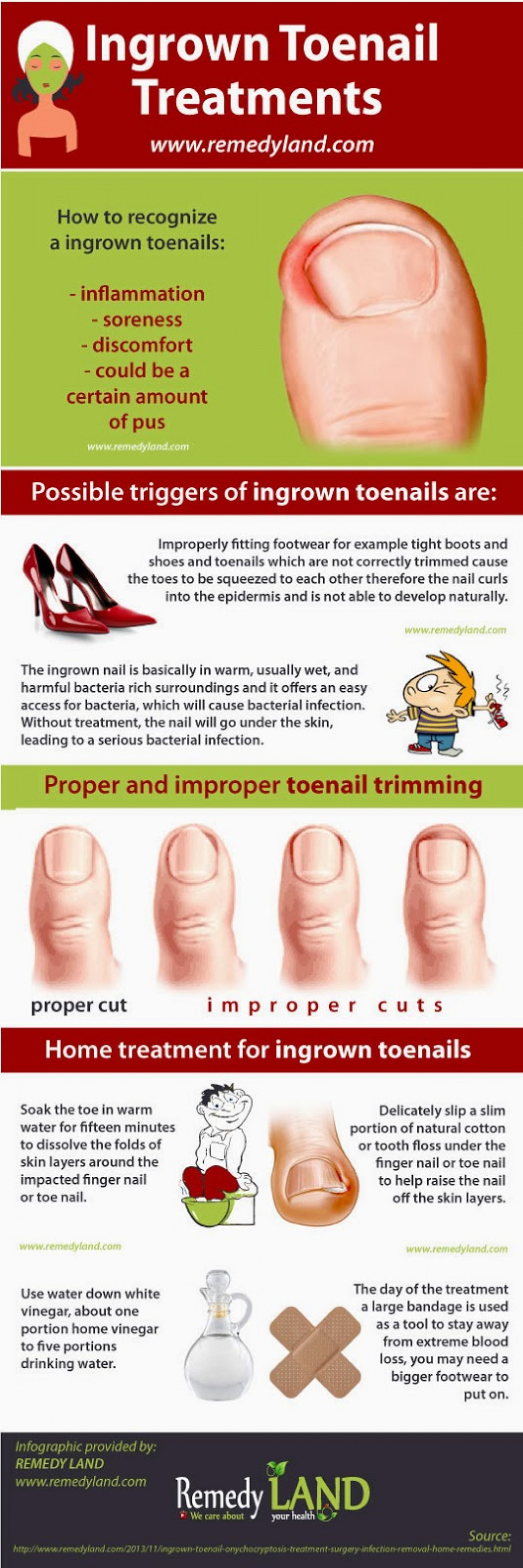 Ingrown Toenails Facts