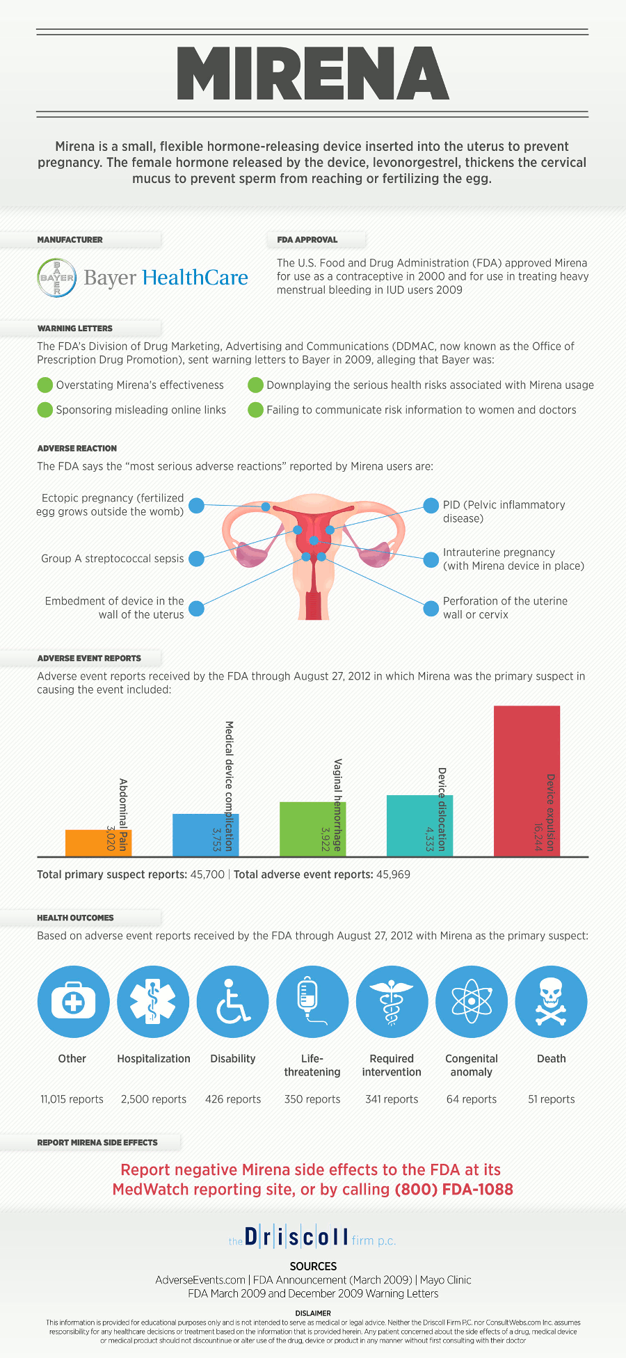 Mirena IUD