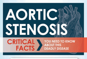 Bicuspid Aortic Valve Symptoms