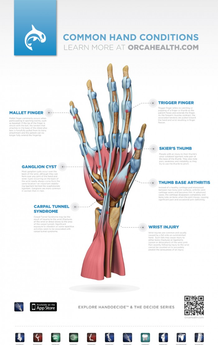 Home Remedies For Trigger Finger - HRF