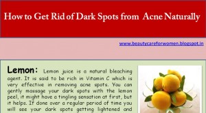 Dark Spot Remover Home Remedies