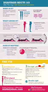 Diastasis Recti 101 AKA The Gap AKA Abdominal Separation