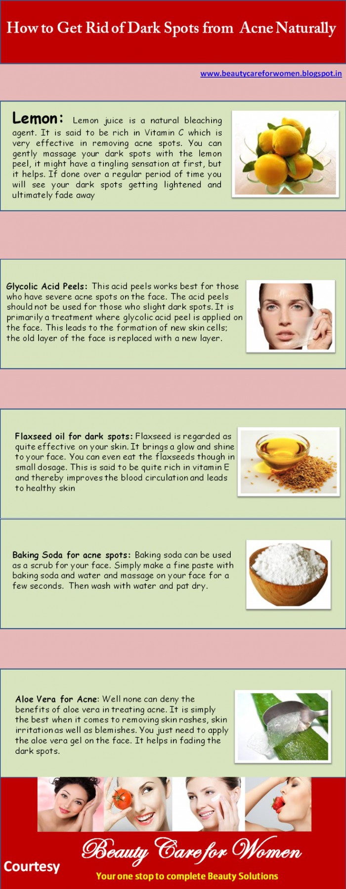 Dark Spot Remover Home Remedies Hrf