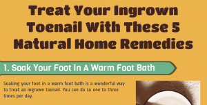 Ingrown Toenail Home Remedies