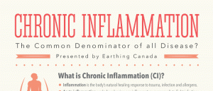 Tietze Syndrome Symptoms