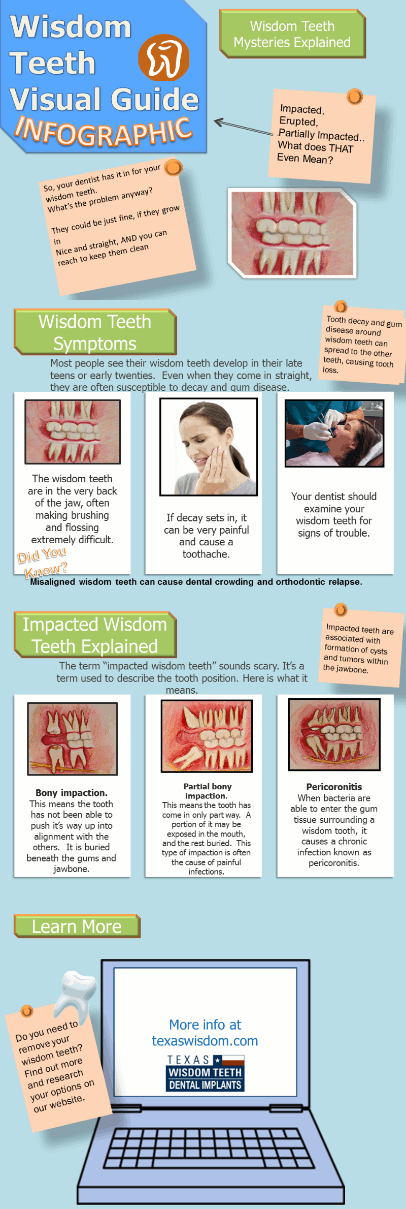 Wisdom Teeth Visual Guide
