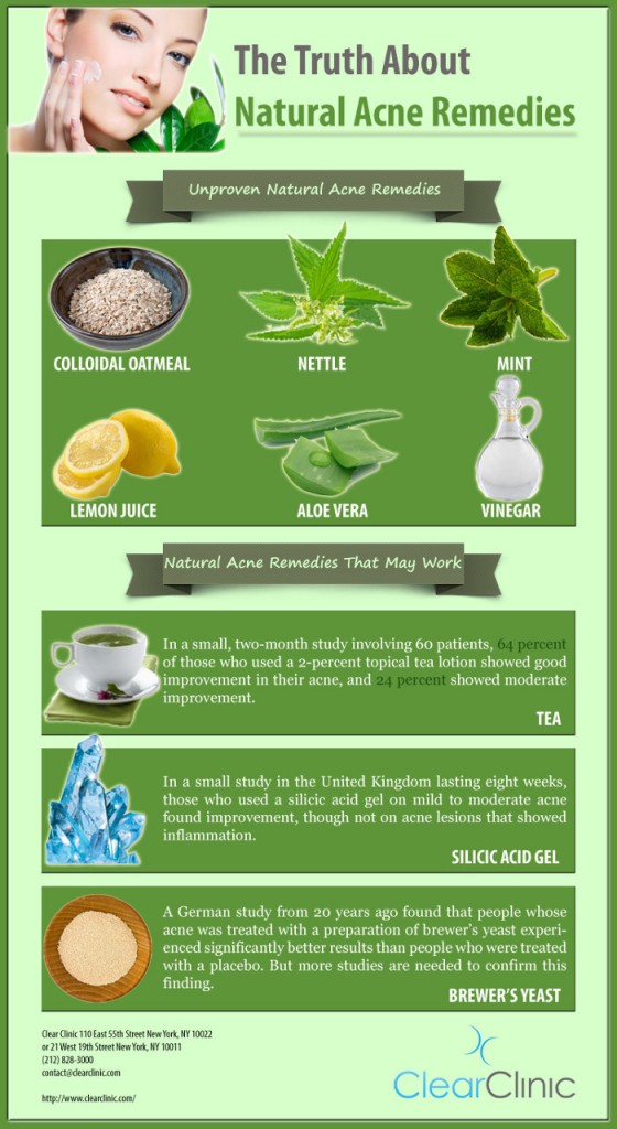 Nodular Acne Home Remedies HRF