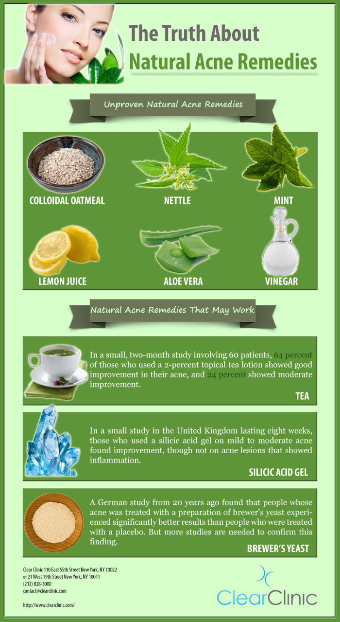 Nodular Acne Home Remedies