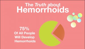 Home Remedies For External Hemorrhoids