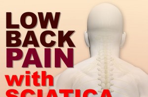 Home Remedies for Sciatic Nerve Pain