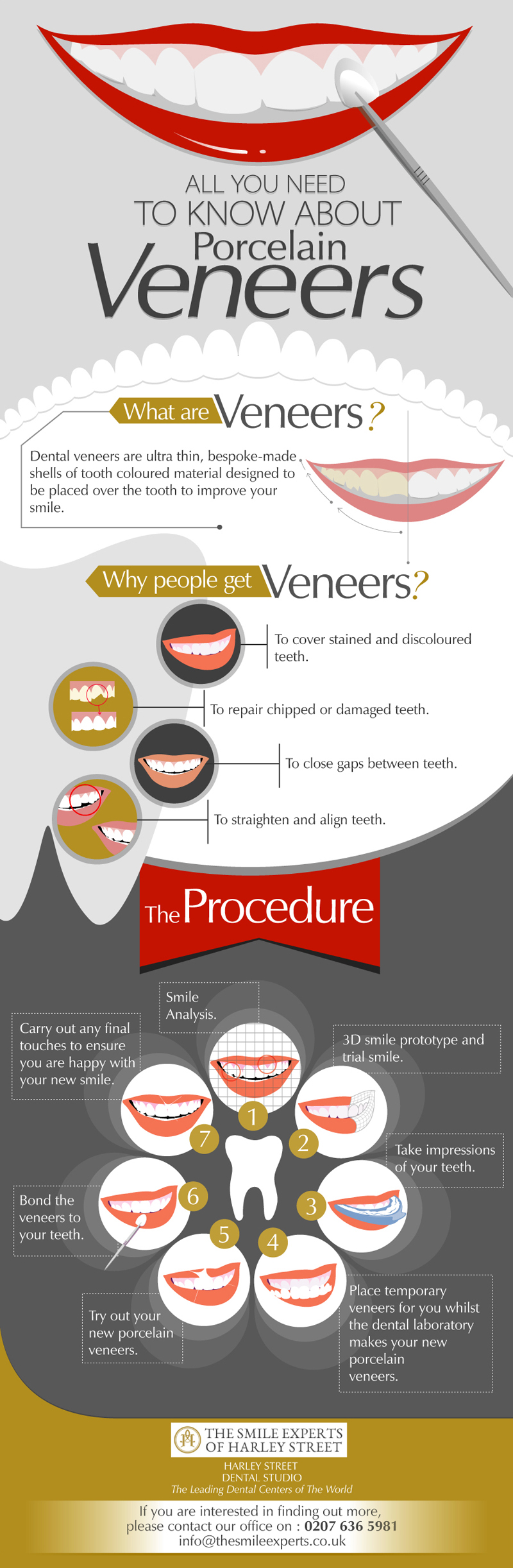 Porcelain Veneers Guide