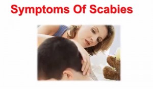 5 Important Facts About Scabies