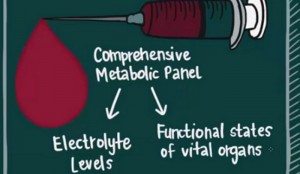 CMP12 Blood Test Results Explained