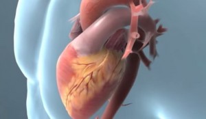 Hypercholesterolemia vs Hyperlipidemia