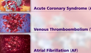 Protime INR Blood Test Results Meaning