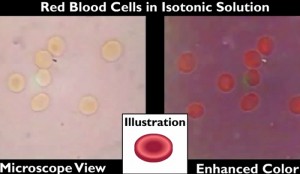 Understanding the Hemolyzed Blood Test Results