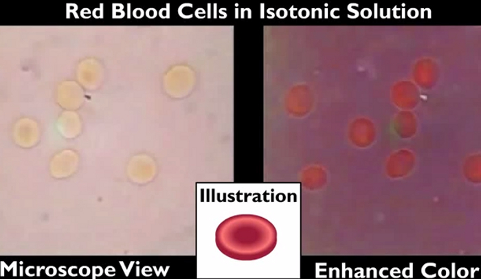 Understanding the Hemolyzed Blood Test Results - HRF