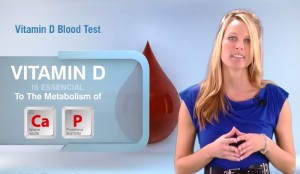 Vitamin D 25 Hydroxy Blood Test Results Explained