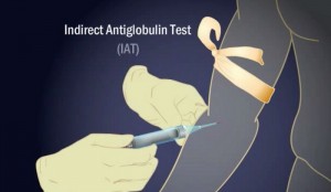 Glob Blood Test Results Fully Explained