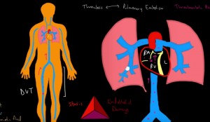 D-dimer Blood Test Results Explained